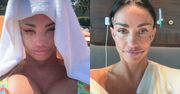 Katie Price pokazała, jak zmieniała się jej twarz po SZÓSTYM liftingu. Internauci nie dowierzają: "Niszczysz siebie"