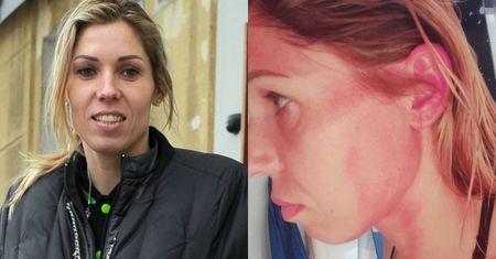 Zofia Klepacka przekazała, że ZOSTAŁA POBITA: "Szturchano mnie, ubliżano, dostałam dwa razy w głowę" (FOTO)