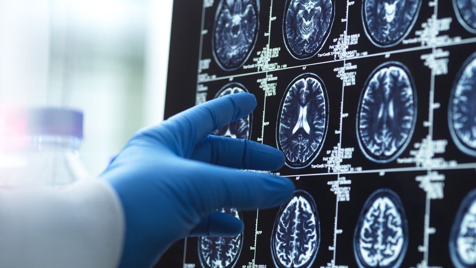 Rozwój mózgu człowieka w czasie całego życia podzielono na 5 etapów