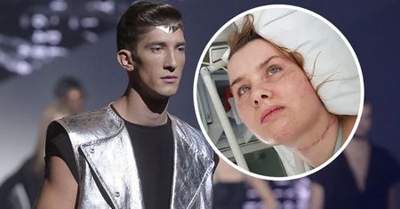 Nikt nie chciał jej leczyć. Michał Baryza z "Top Model" jest wyjątkiem