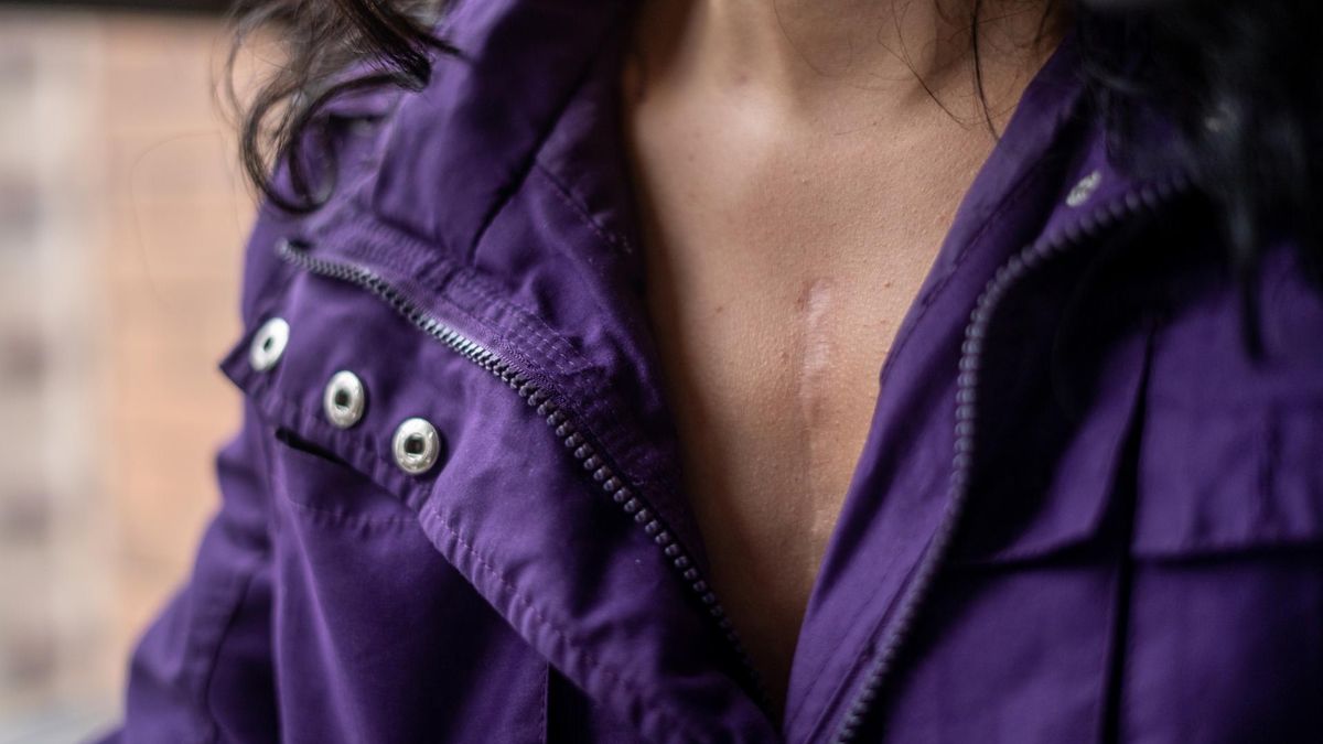 Insulinooporność pogarsza rokowania u pacjentów, u których zdiagnozowano raka piersi: zwiększa ryzyko zgonu i przerzutów odległych