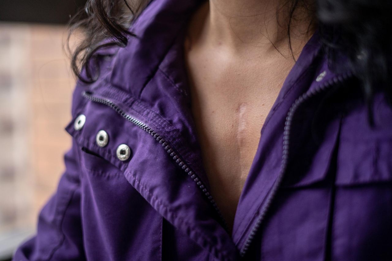 Insulinooporność to nie tylko wstęp do cukrzycy. "Jest czynnikiem napędzającym rozwój nowotworów"