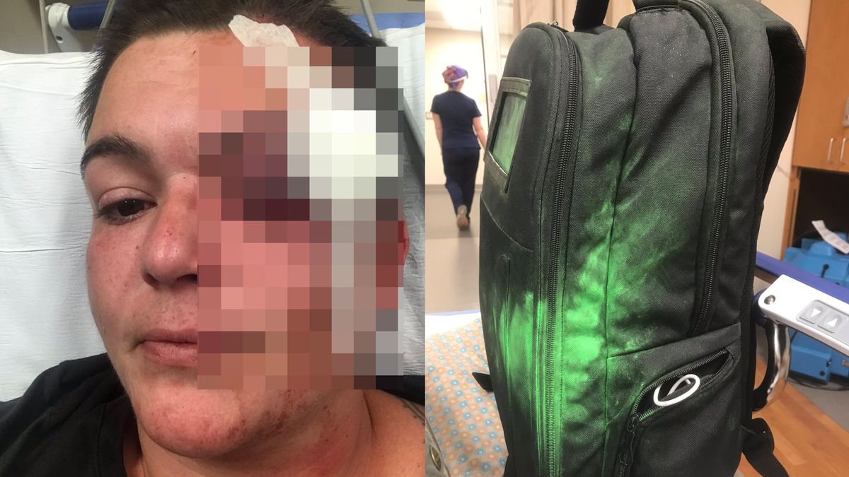 Fotografowie i dziennikarze atakowani przez policję w USA. Są poszkodowani 1