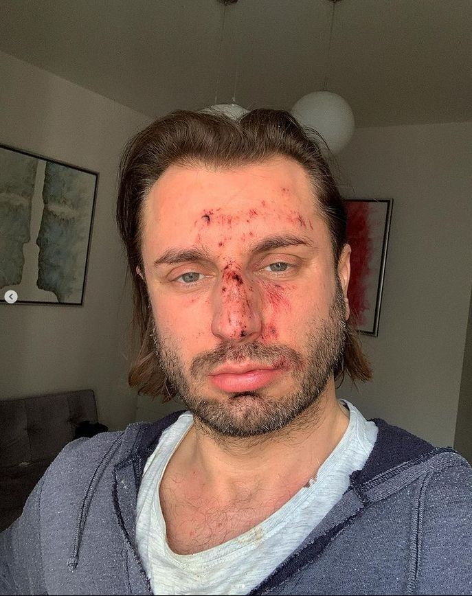 Rafał Grabias został pobity i okradziony
