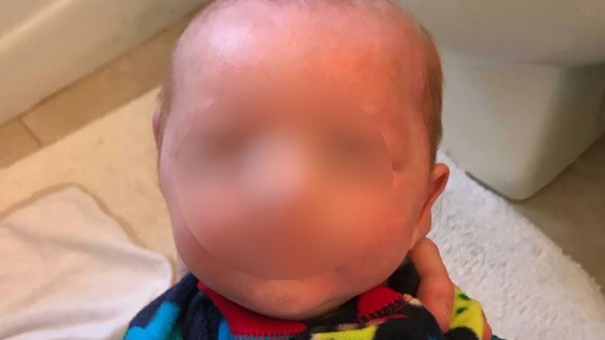 Hudson miał siedem tygodni, kiedy został pobity na śmierć przez swojego ojca