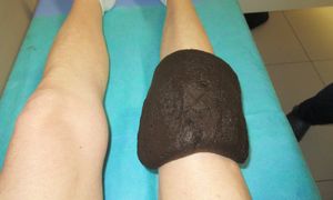 Trzy tygodnie leczenia uzdrowiskowego za darmo. Oto komu przysługuje