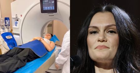 Jessie J TRAFIŁA DO SZPITALA na chwilę przed koncertem: "Myślałam, że złamałam kark" (FOTO)