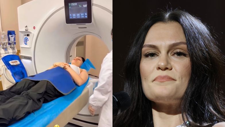 Jessie J TRAFIŁA DO SZPITALA na chwilę przed koncertem: "Myślałam, iż złamałam kark" (FOTO)