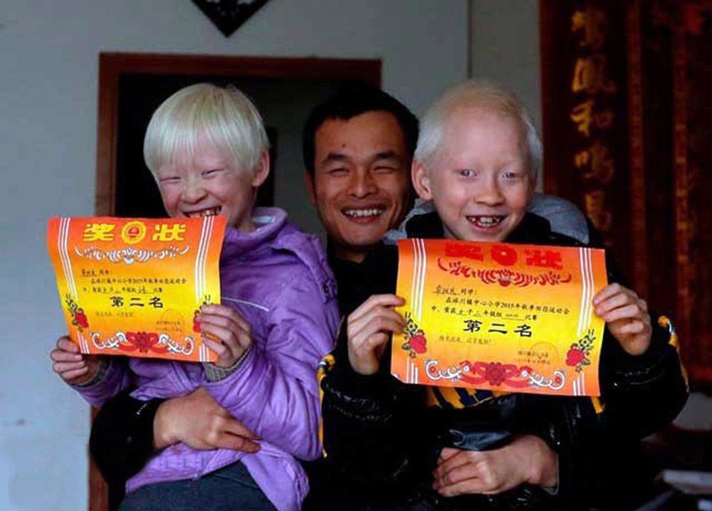 Policjant przygarnął bliźnięta. Rodzice nie chcieli albinosów