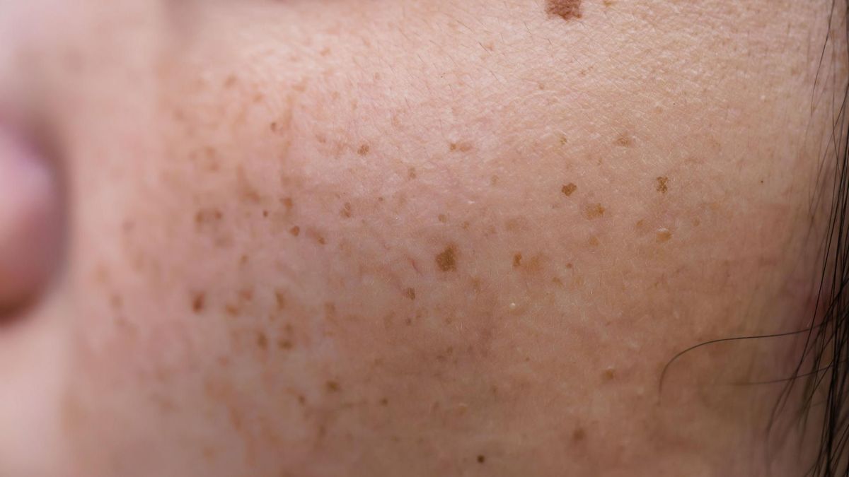 Witaminę D pozyskujemy dzięki promieniom słonecznym. Jeśli jest jej za mało - nasz organizm wysyła nam znaki  (123rf.com)