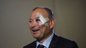 Podbite oko i opatrunek na skroni. Wygląd trenera Anglików zszokował dziennikarzy