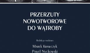 Przerzuty nowotworowe do wątroby