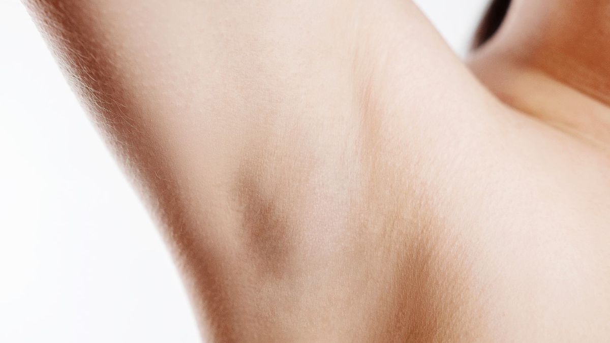 Guzek pod pachą nie zawsze oznacza zmianę nowotworową, ale u większości pacjentów budzi pewien niepokój.