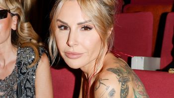 Blanka Lipińska przeżyła kiedyś atak psa. "Rozszarpał mi PÓŁ TWARZY"