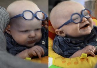 Chłopiec albinos po raz pierwszy zobaczył mamę!