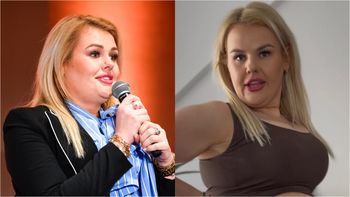 Kinga Zawodnik pokazuje, jak wygląda jej brzuch po operacji bariatrycznej i ogłasza, że NIE ZAMIERZA usuwać nadmiaru skóry (FOTO)