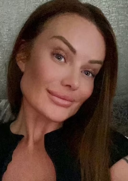 Sharon nie zauważyła żadnej różnicy po operacji nosa