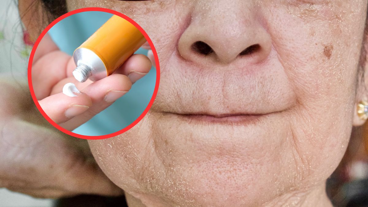 Jak pozbyć się zmarszczek? Maść z apteki może pomóc