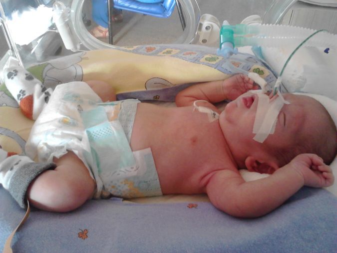 Stan chłopca nadal nie jest zadowalający, maluszek cierpi na dysplazję oskrzelowo-płucną. / Archiwum prywatne