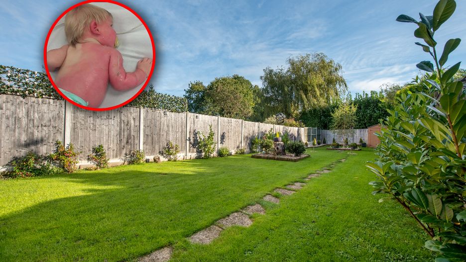 Woda z węża ogrodowego wystawiona na bezpośrednie działanie promieni słonecznych może poparzyć skórę