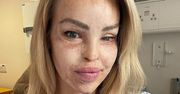 13 lat temu została oblana kwasem. Co robi teraz Katie Piper – ofiara tragicznego zdarzenia?