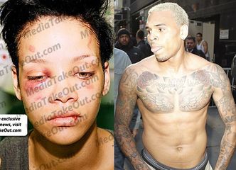 Chris Brown BIJE LUDZI, bo ma "zaburzenie dwubiegunowe"?