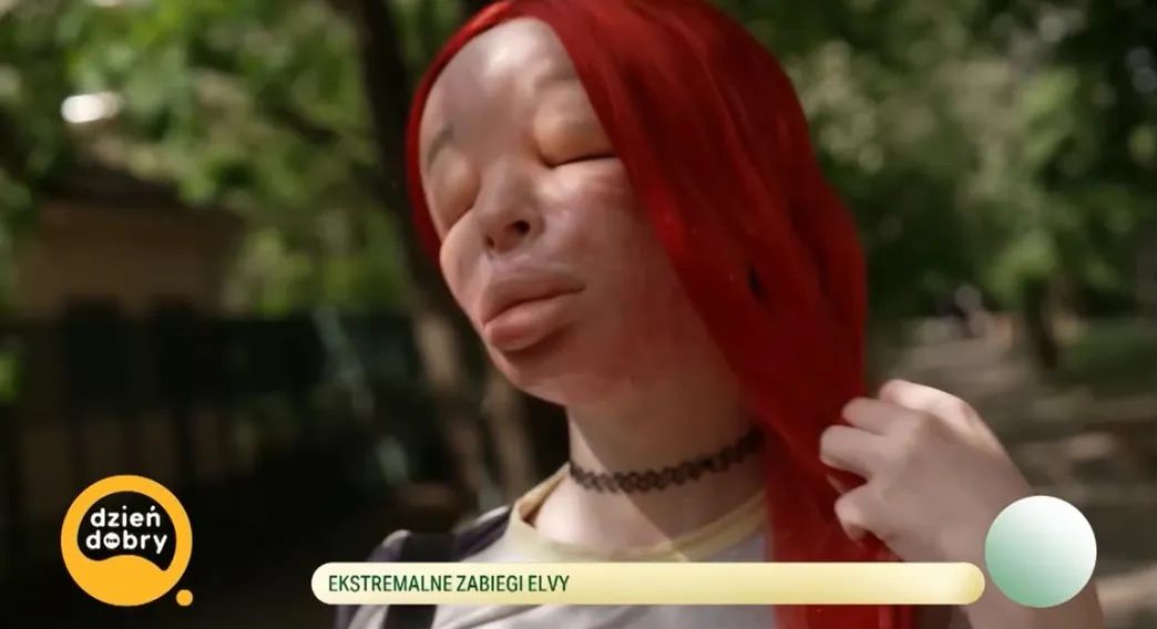 Elva