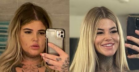 Brytyjka zrzuciła 90 kilogramów i przeszła kilka operacji za kilkadziesiąt tysięcy. Pochwaliła się efektem metamorfozy