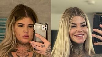 Brytyjka zrzuciła 90 kilogramów i przeszła kilka operacji za kilkadziesiąt tysięcy. Pochwaliła się efektem metamorfozy