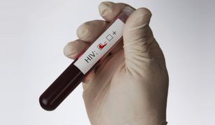 Test na HIV w 15 minut, za 3 złote