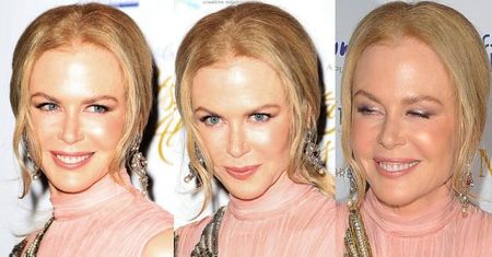 Błyszcząca, gładka twarz Nicole Kidman (ZDJĘCIA)