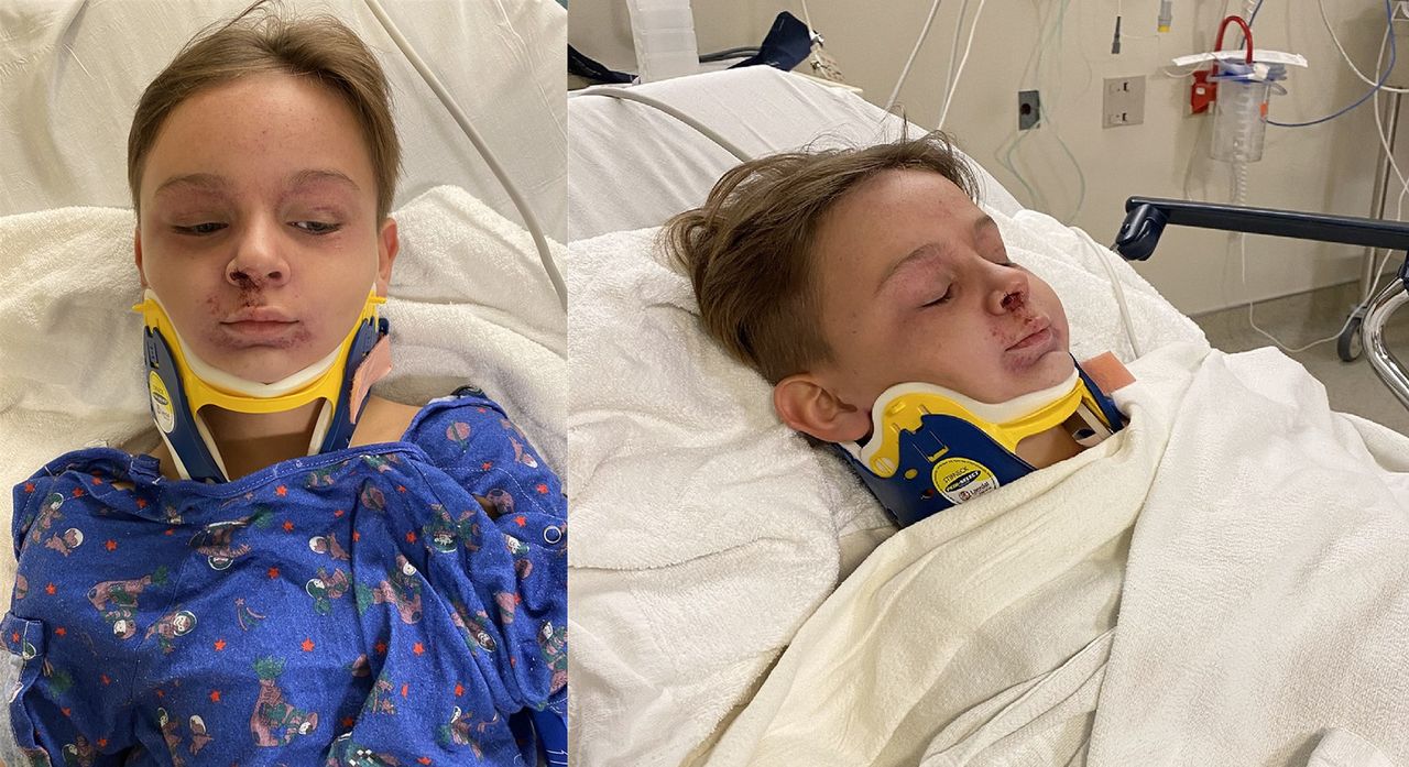 8-letni chłopiec o mało nie udusił się pasami bezpieczeństwa. "Miał owiniętą całą szyję"