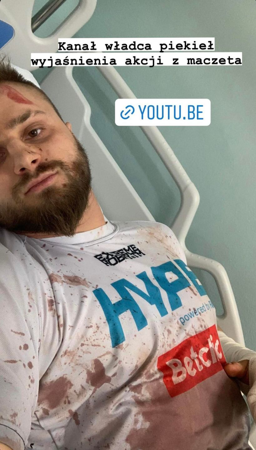 Gwiazdor Fame MMA został napadnięty we własnym domu?!