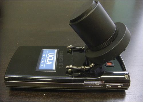 Telefon komórkowy wykrywa choroby... jako mikroskop