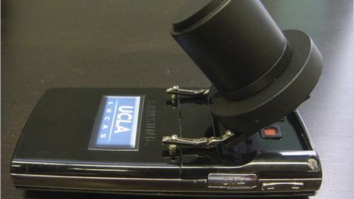 Telefon komórkowy wykrywa choroby... jako mikroskop 1