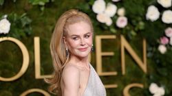 Co się stało z Nicole Kidman? "Uszy nietoperza"
