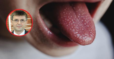 Groźny paciorkowiec szaleje na Wyspach. Pediatra ma ważną radę dla rodziców