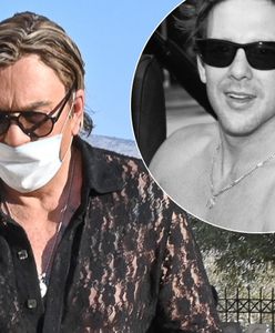 Mickey Rourke ma zmasakrowaną twarz. Wszystko przez operacje