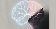 Utrata estrogenu niszczy rusztowanie mózgu. Nowe badanie tłumaczy, dlaczego kobiety częściej chorują na Alzheimera