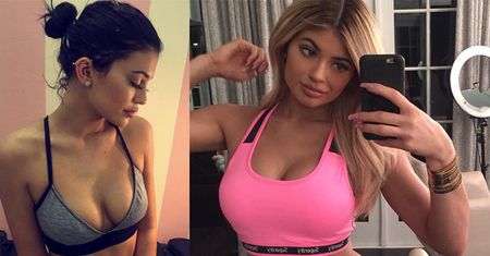 Kylie: "Nie mam żadnych implantów piersi!"