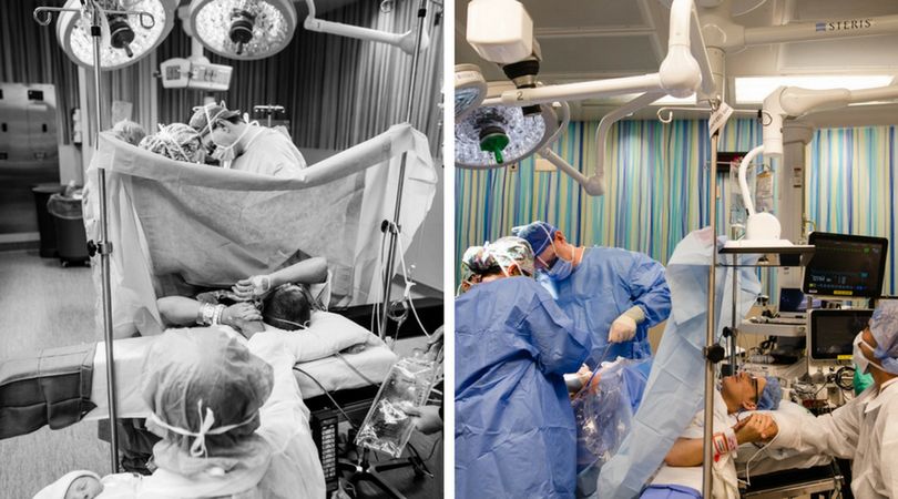 Zespół medyczny dokonuje cesarskiego cięcia chorującej na raka Marii Crider