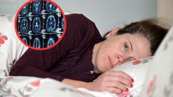 Demencja zaczyna się od serca. Kluczowe są decyzje w średnim wieku