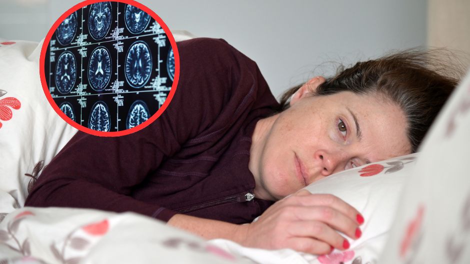 Demencja zaczyna się od serca. Kluczowe są decyzje w średnim wieku