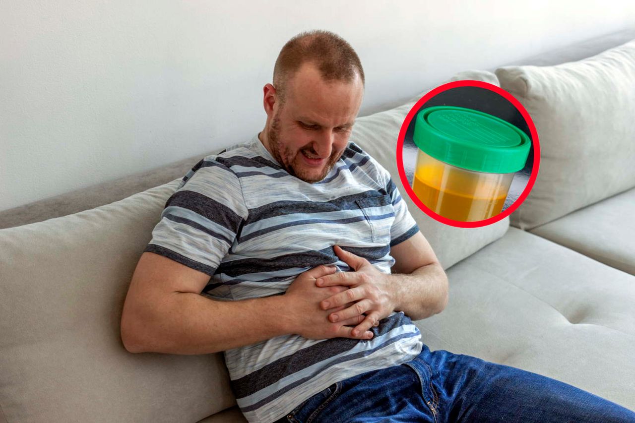 Zwróć uwagę na kolor moczu. Sygnał, że rak panoszy się w ciele