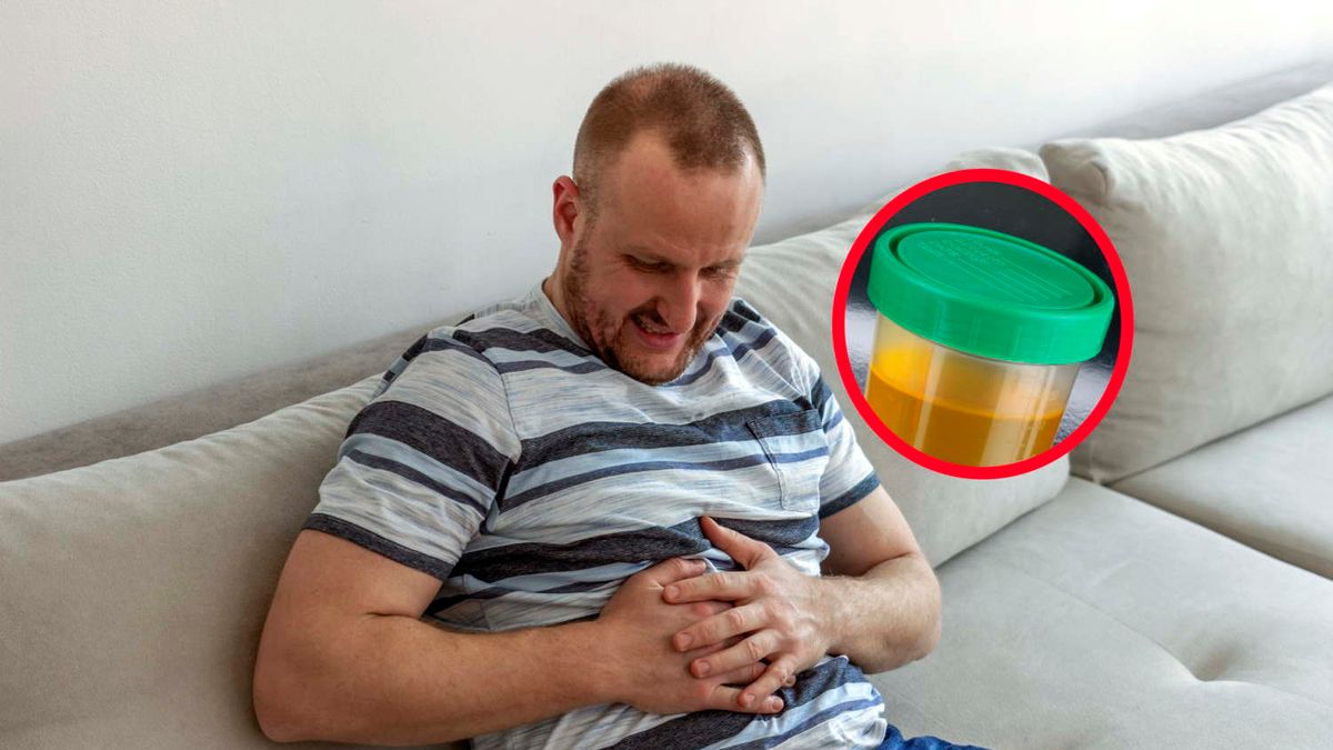 Pierwszy objaw raka trzustki. Zwróć uwagę na szczegół