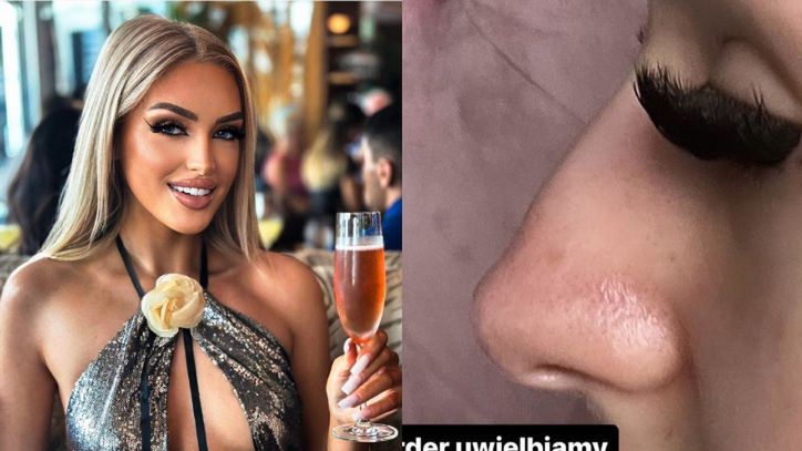 Fanka do Caroline Derpienski: "Masz GARBKA na nosie"