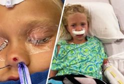 Strzałka przebiła czaszkę 7-latki. "To cud, że w ogóle mogła chodzić"