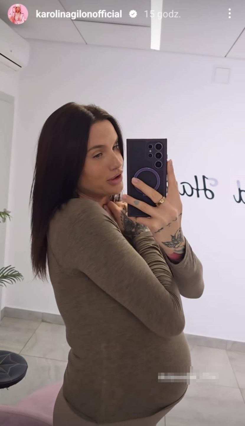 Karolina Gilon bez doczepów