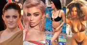 Od "brzydkiego kaczątka" do najpopularniejszej seksbomby na świecie: Kylie Jenner skończyła 23 lata (ZDJĘCIA)
