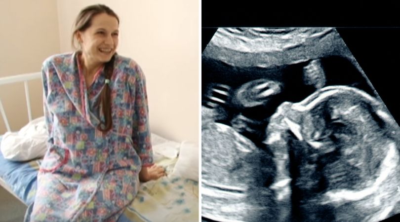 Poszła do lekarza dopiero pod koniec ciąży. To, co zobaczyli odebrało im mowę 